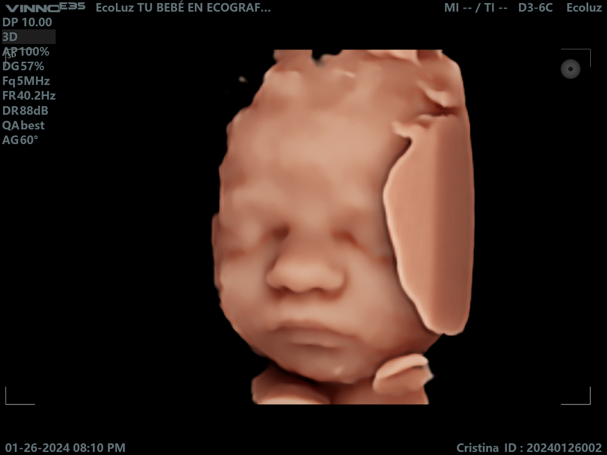 Ecografía 30 semanas: tu bebé está casi listo